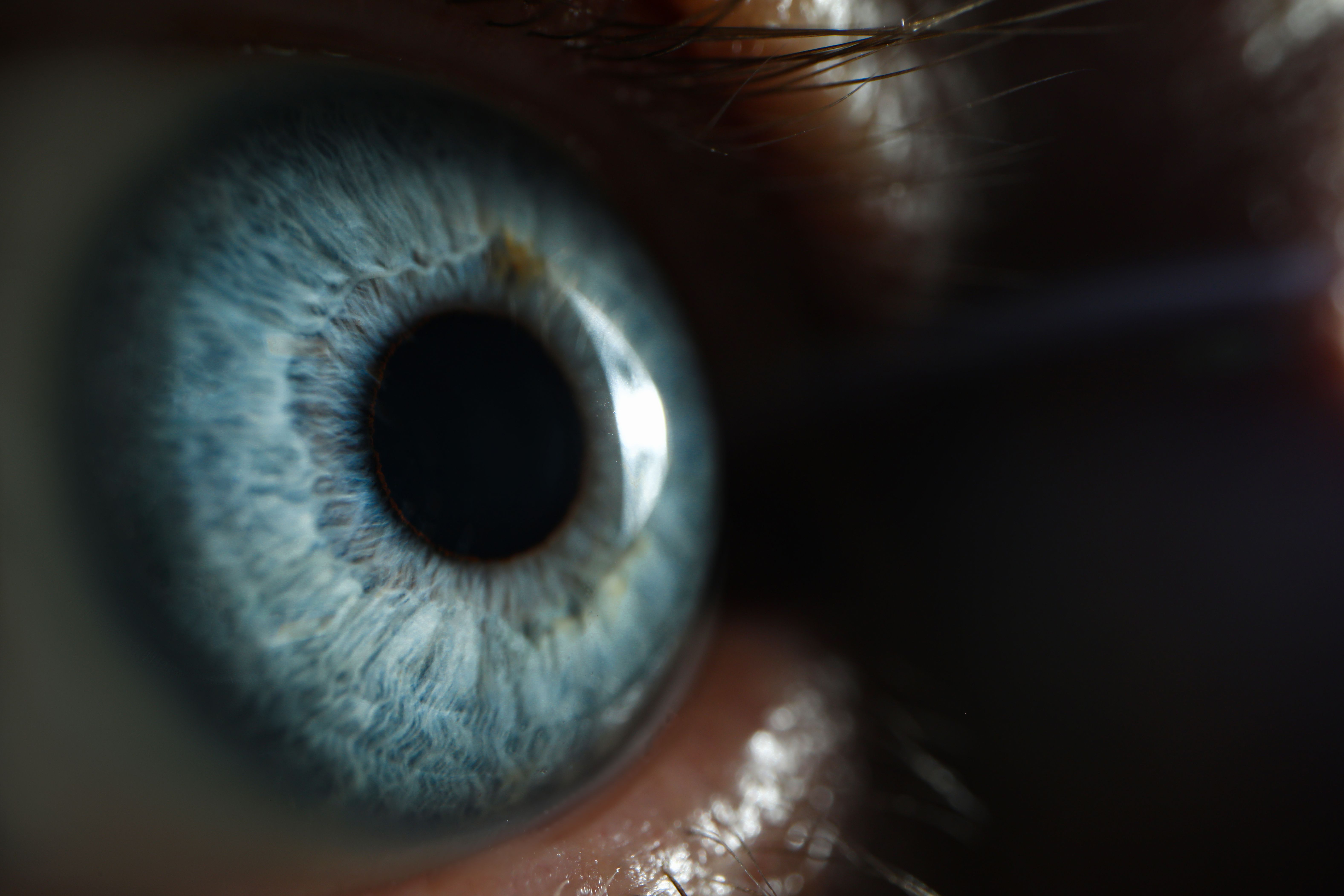 glaucoma monitoring