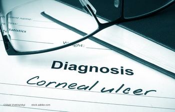 (Image credit: AdobeStock/Vitalii Vodolazskyi) Yale researchers identify corneal ulcer pathogens by testing tears