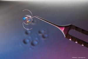 Personalized IOL selection starts with expectations