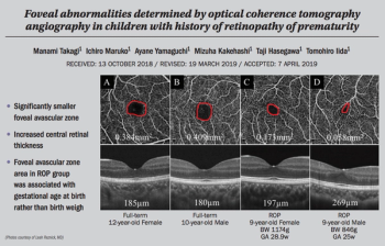 Foveal abnormalities determined by OCTA in children with history of ROP