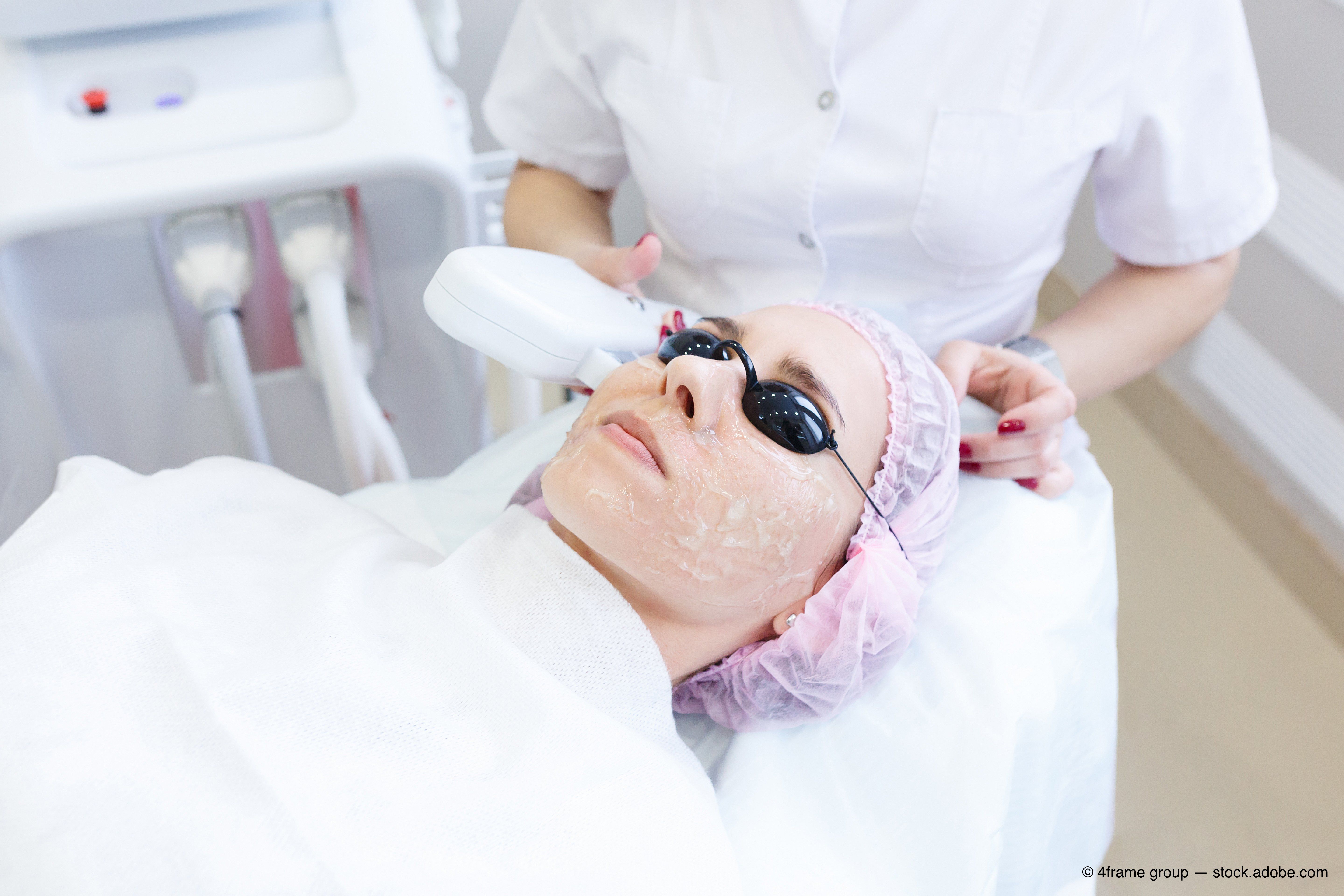 Understand The Expanding Role Of Ipl In Dry Eye Disease Understand The Expanding Role Of Ipl In Dry Eye Disease