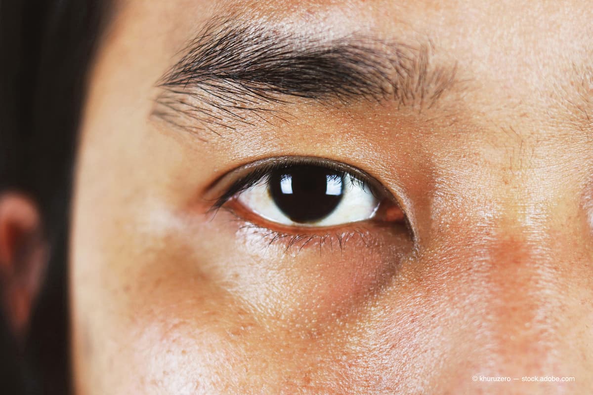Retrospective study of AMD remote monitoring shows improved outcomes ...