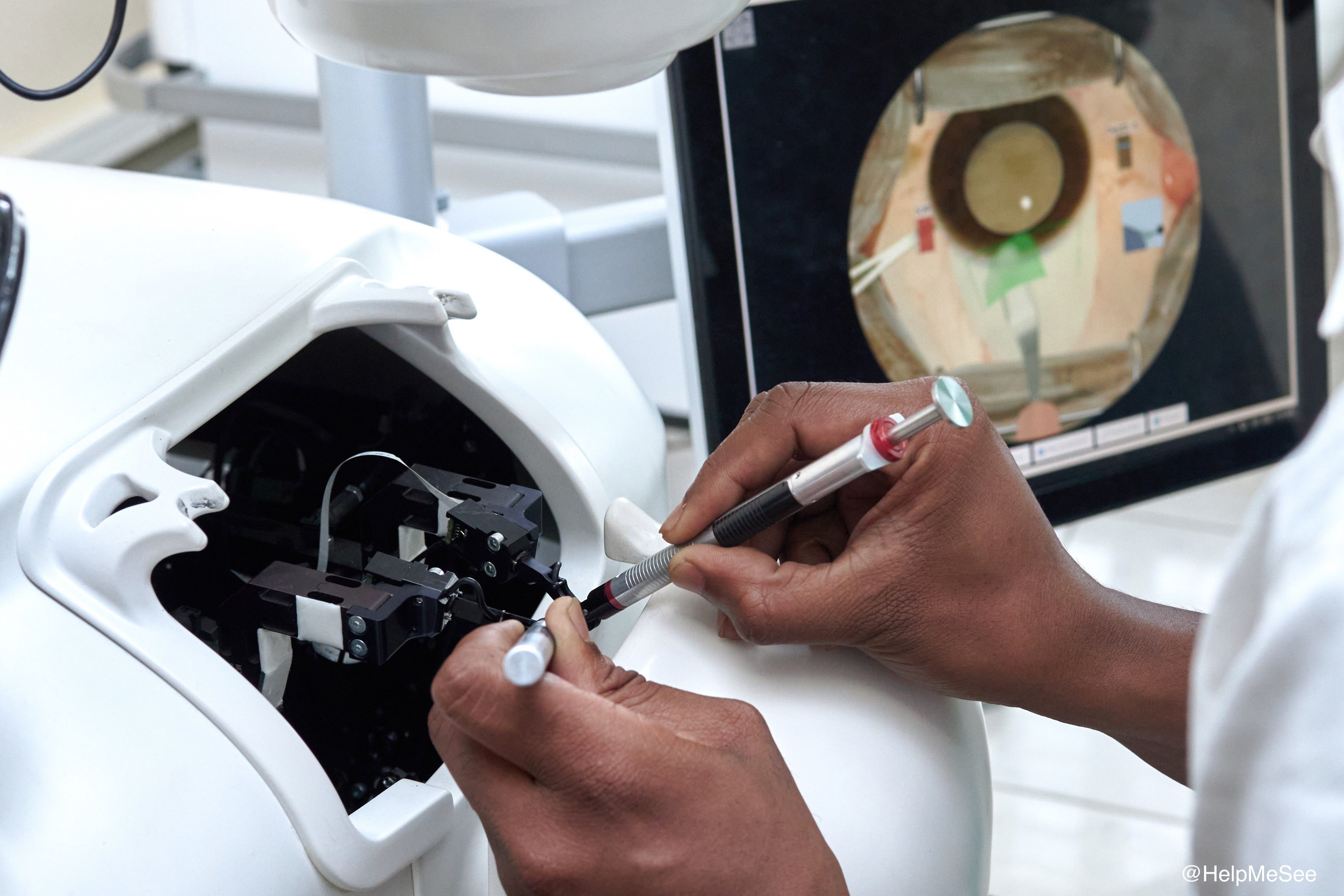 With its ability to provide the feel of a human eye in training, the HelpMeSee simulation-based training program helps trainees enhance their surgical skills and add confidence. (Image credit: HelpMeSee) With its ability to provide the feel of a human eye in training, the HelpMeSee simulation-based training program helps trainees enhance their surgical skills and add confidence. (Image credit: HelpMeSee)