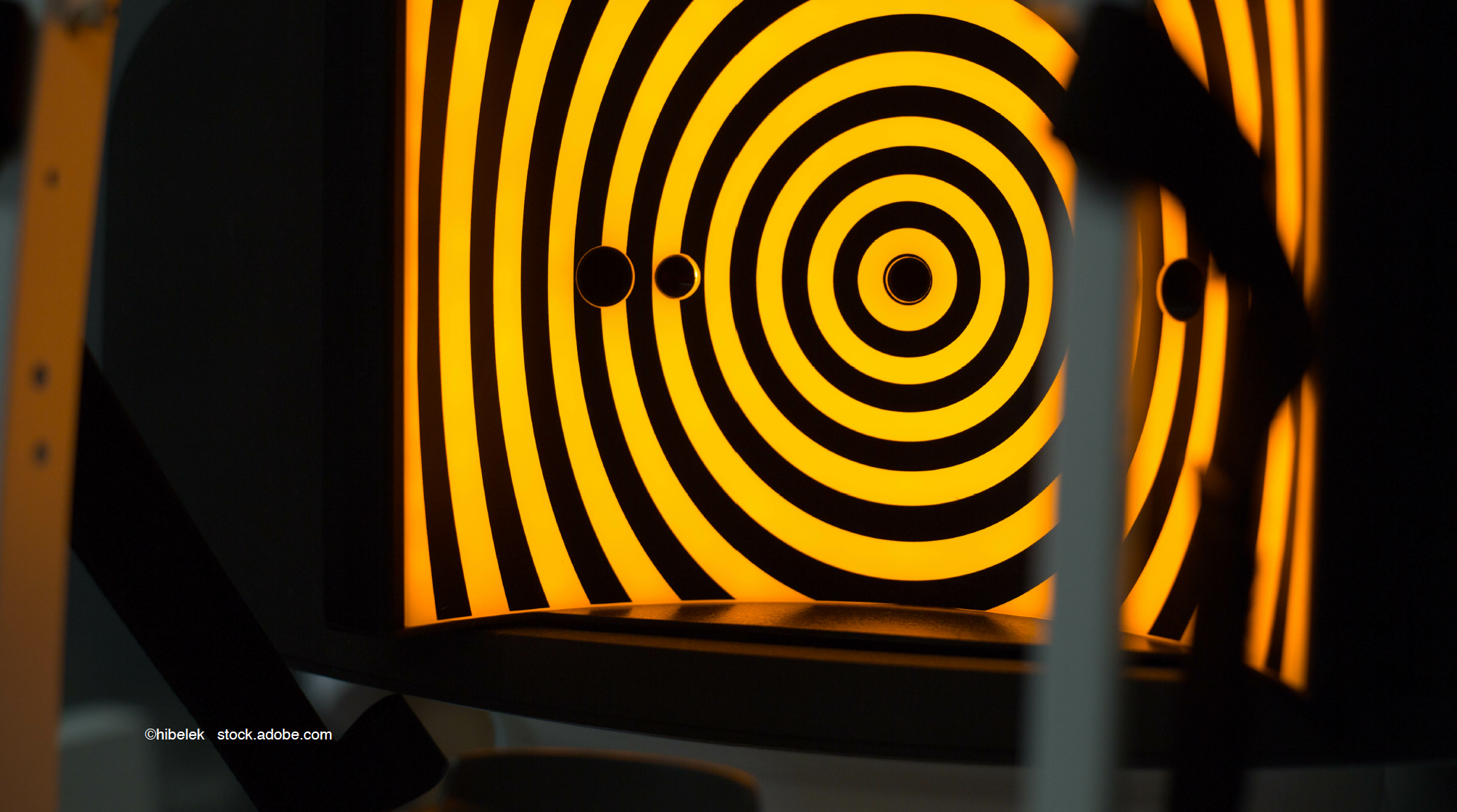 Considering keratoconus-like changes after DMEK in Fuchs' dystrophy