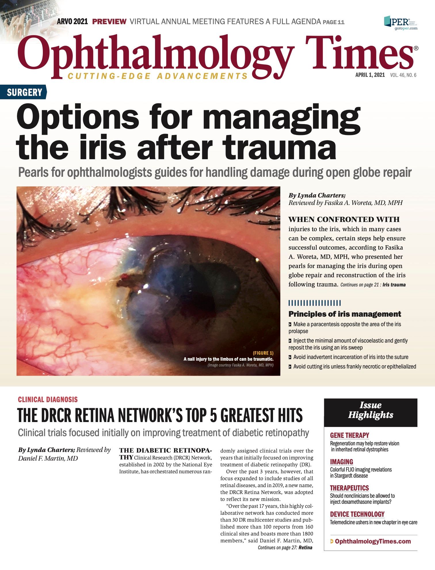 Unplugging The Clogged Drain In Glaucoma IOP