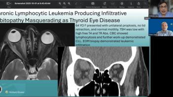 (Image credit: Andrew G. Lee, MD, and Drew Carey, MD) NeuroOp Guru: When proptosis isn’t thyroid eye disease