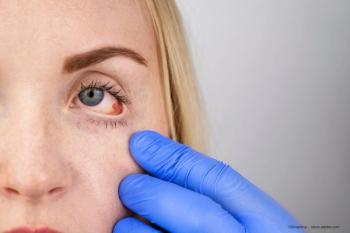 A woman is seen with a red eye and a hand with a blue glove