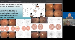 NeuroOp Guru: Novel mitochondrial mutation found in a case of isolated LHON