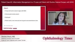 EP. 3 Patient Case #2: Inflammation management in a 73-year-old patient with routine cataract surgery with MIGS