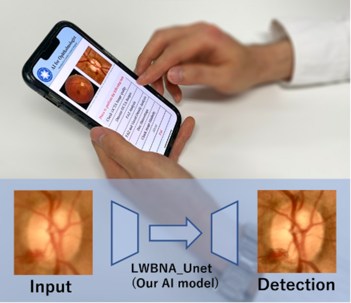 New deep learning model helps the automated screening of common eye ...