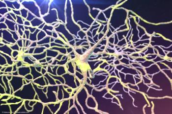 Addressing GA by downregulating overactive complement system