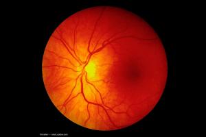Orbital and retinal microvascular changes in thyroid eye disease