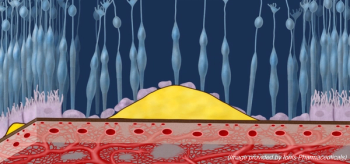 Connecting the dots between the complement pathway and geographic atrophy