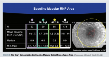Impact of aflibercept on retinal nonperfusion in DME