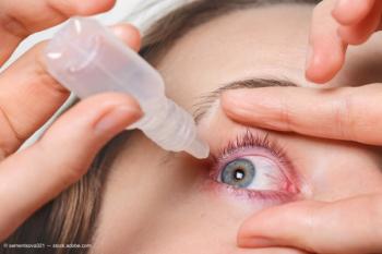 dry eyes