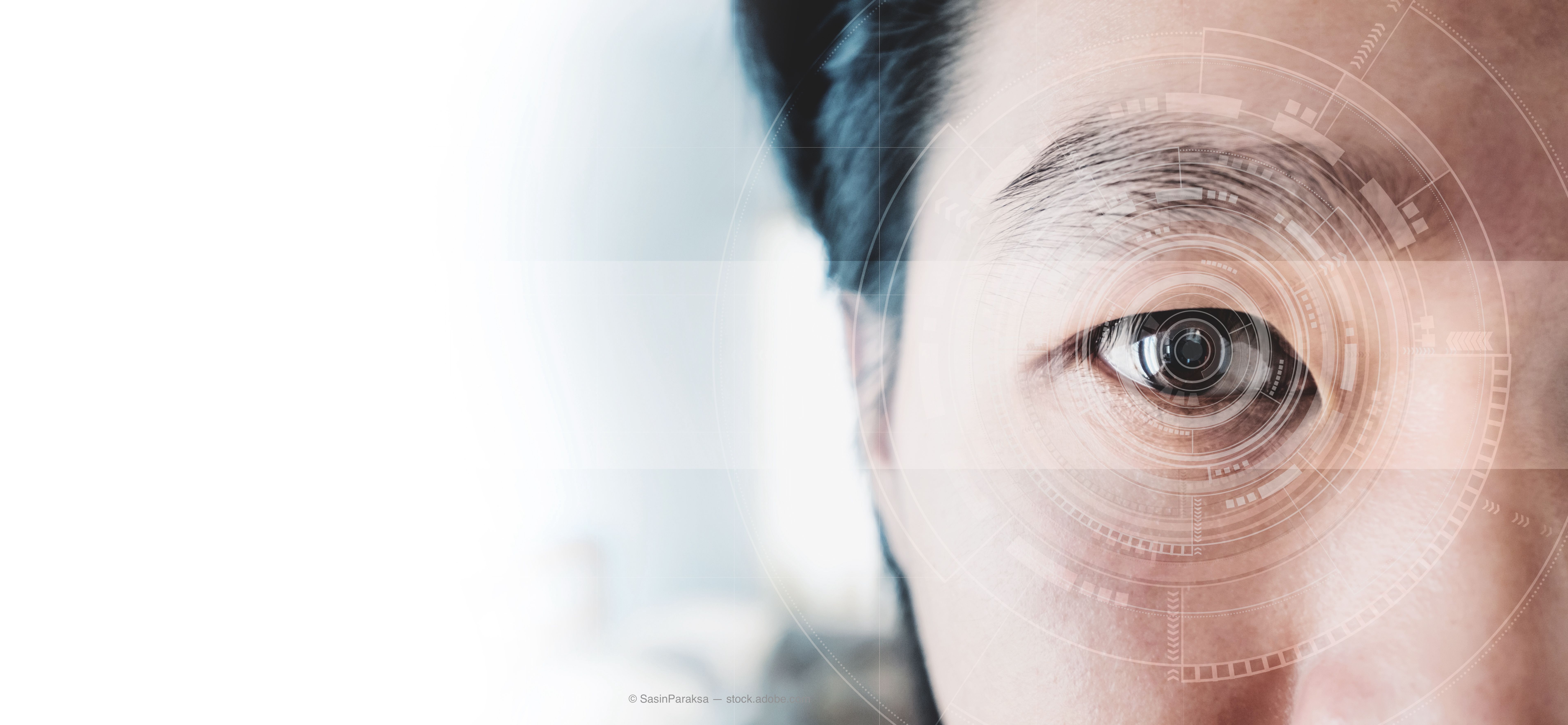 Home monitoring patients for AMD: Targeting CNV