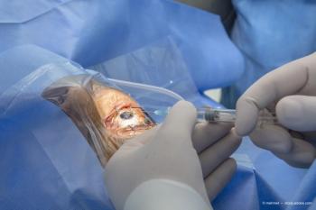 Treating age-related macular degeneration (AMD) with eye injections