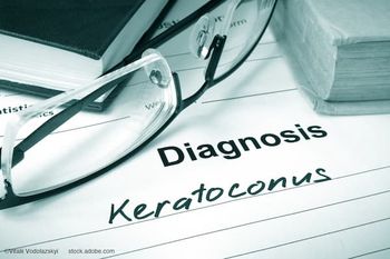 (Image credit: AdobeStock/Vitalii Vodolazskyi) Incision-free cross-linking marks a new era for keratoconus care