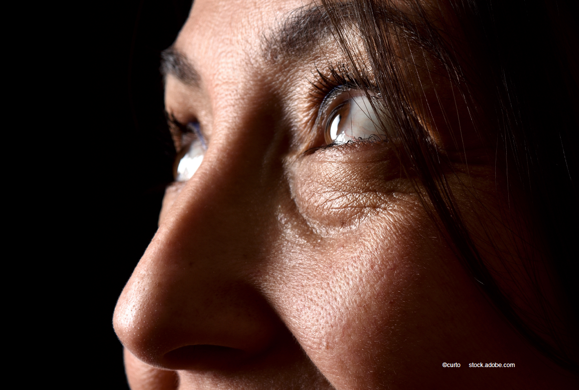Blepharoptosis in patients with an ocular prosthesis: Use of a novel template prosthesis