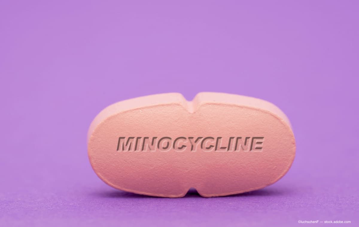 Study Shows Minocycline Has No Benefit In Slowing Geographic Atrophy ...