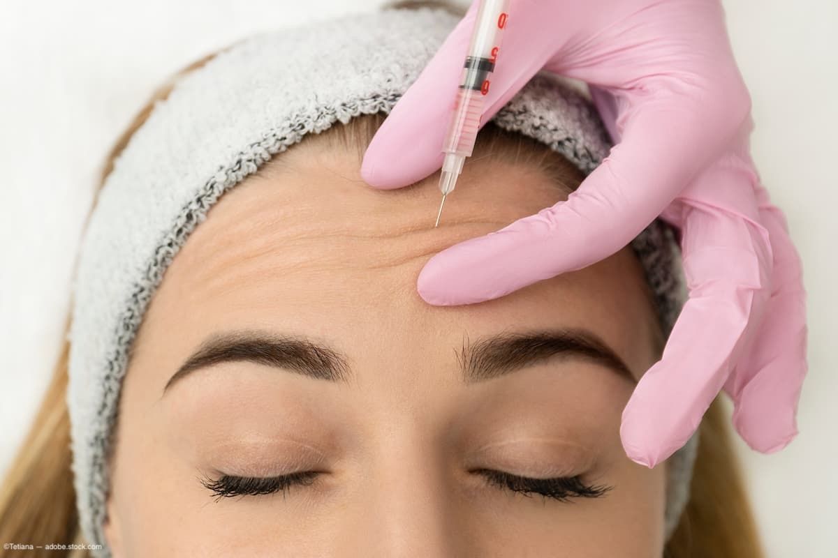  Cosmetic procedures associated with serious ophthalmologic complications