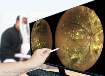 Risk factors for vision loss with untreated DME