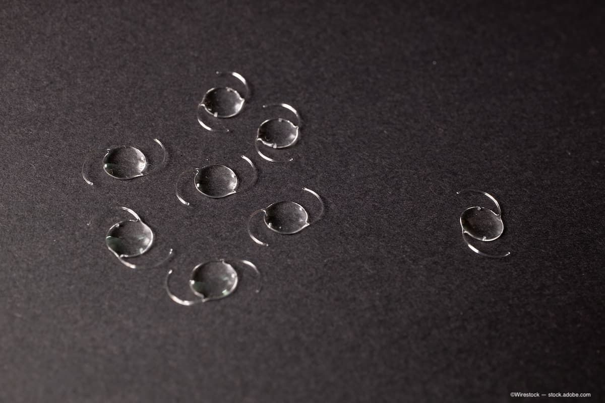 (Image Credit: AdobeStock/Wirestock) (Image Credit: AdobeStock/Wirestock)