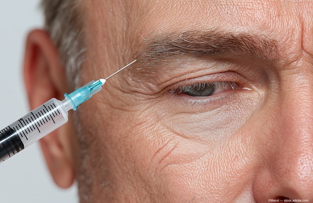 tPA: A (new) tool in the uveitis armamentarium for patient care