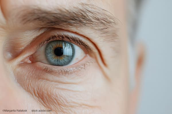 (Image credit: AdobeStock/Margarita Ratatosk) Q&A: William F. Wiley, MD, on what BVI's trifocal IOL approval means for US premium vision options