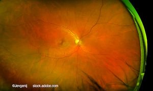 (Image credit: AdobeStock/Jevgenij) Q&A: Advancing a long-acting anti-VEGF candidate: What it means for retinal disease