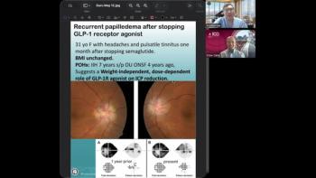 (Image credit: Andrew G. Lee, MD; Andrew Carey, MD) NeuroOp Guru: Stopping GLP-1 therapy may trigger recurrent papilledema in IIH cases