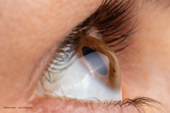 More to keratoconus than meets the cornea: Be sure to flip the lids