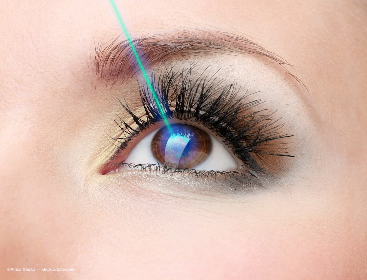 Image of a woman's eye with a blue laser going into it to symbolize laser corrective surgery.