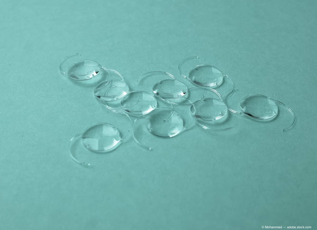 BVI Medical launches PODEYE, a hydrophobic monofocal IOL, in Japan