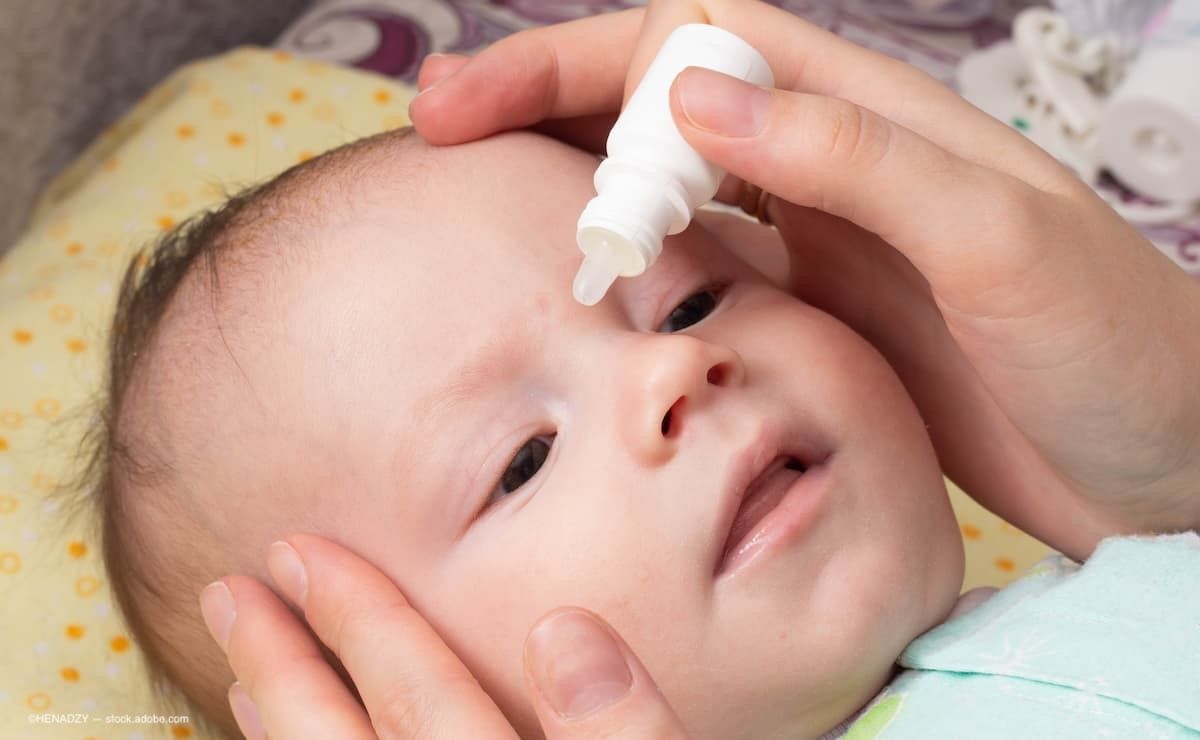 Microdrops show promise for safer retinopathy of prematurity screening in preterm infants