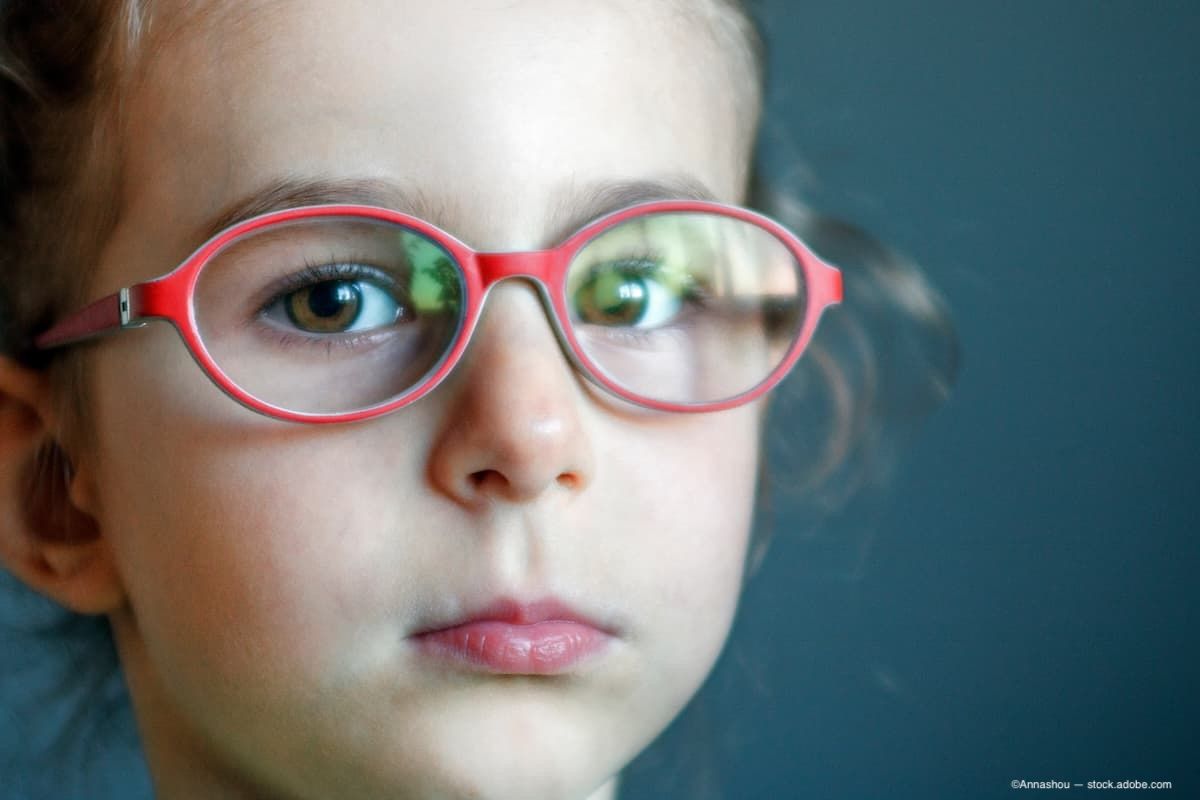 Binocular amblyopia home treatment: The next step after patching