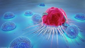 Darovasertib combination shows progression-free survival benefit in metastatic uveal melanoma