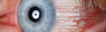 Reducing burden on veterans undergoing cataract surgery
