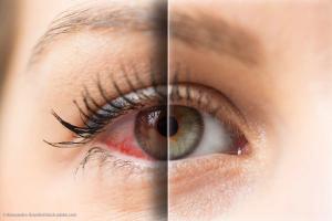 New for 2020 and beyond: Dry eye disease agents in pipeline 