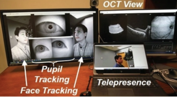 Robotically aligned OCT has potential for use in telemedicine
