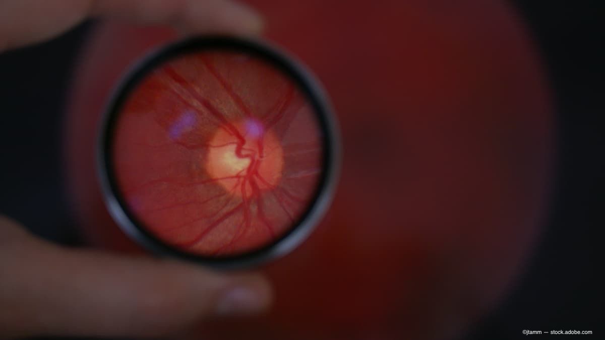 (Image Credit: AdobeStock/jtamm) (Image Credit: AdobeStock/jtamm)