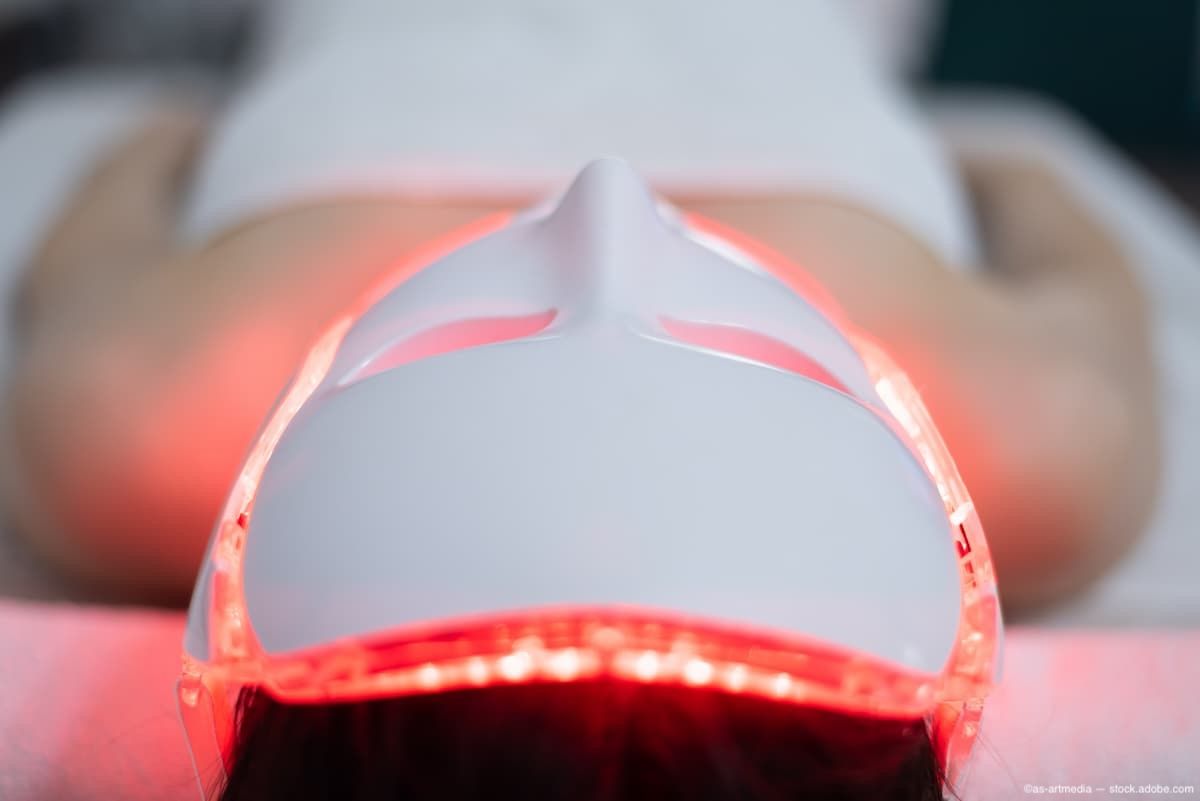 Noninvasive LED light therapy shows long-term safety in early cataract clinical follow-up | Ophthalmology Times - Clinical Insights for Eye Specialists
