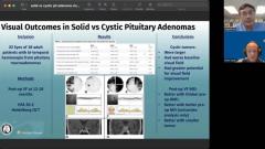 EP. 12 NeuroOp Guru: Visual outcomes in solid versus cystic pituitary adenomas