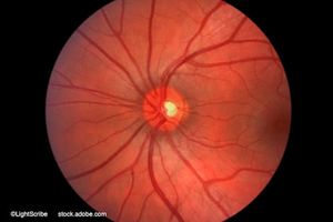 (Image credit: AdobeStock/LightScribe)