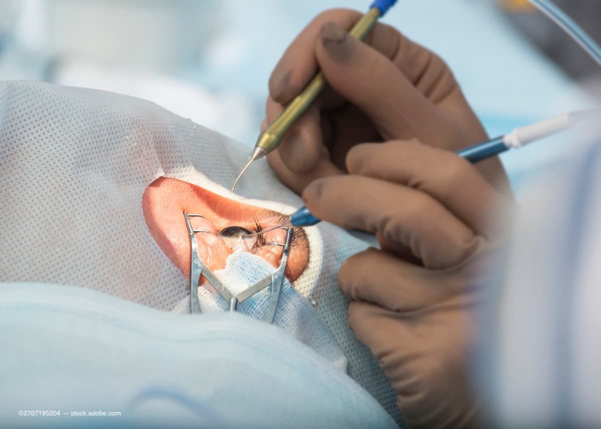 APAO 2023: Beveled tip probe an all-in-one instrument for retinal ...