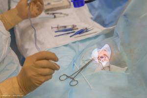 no magic bullet for IOL calculations