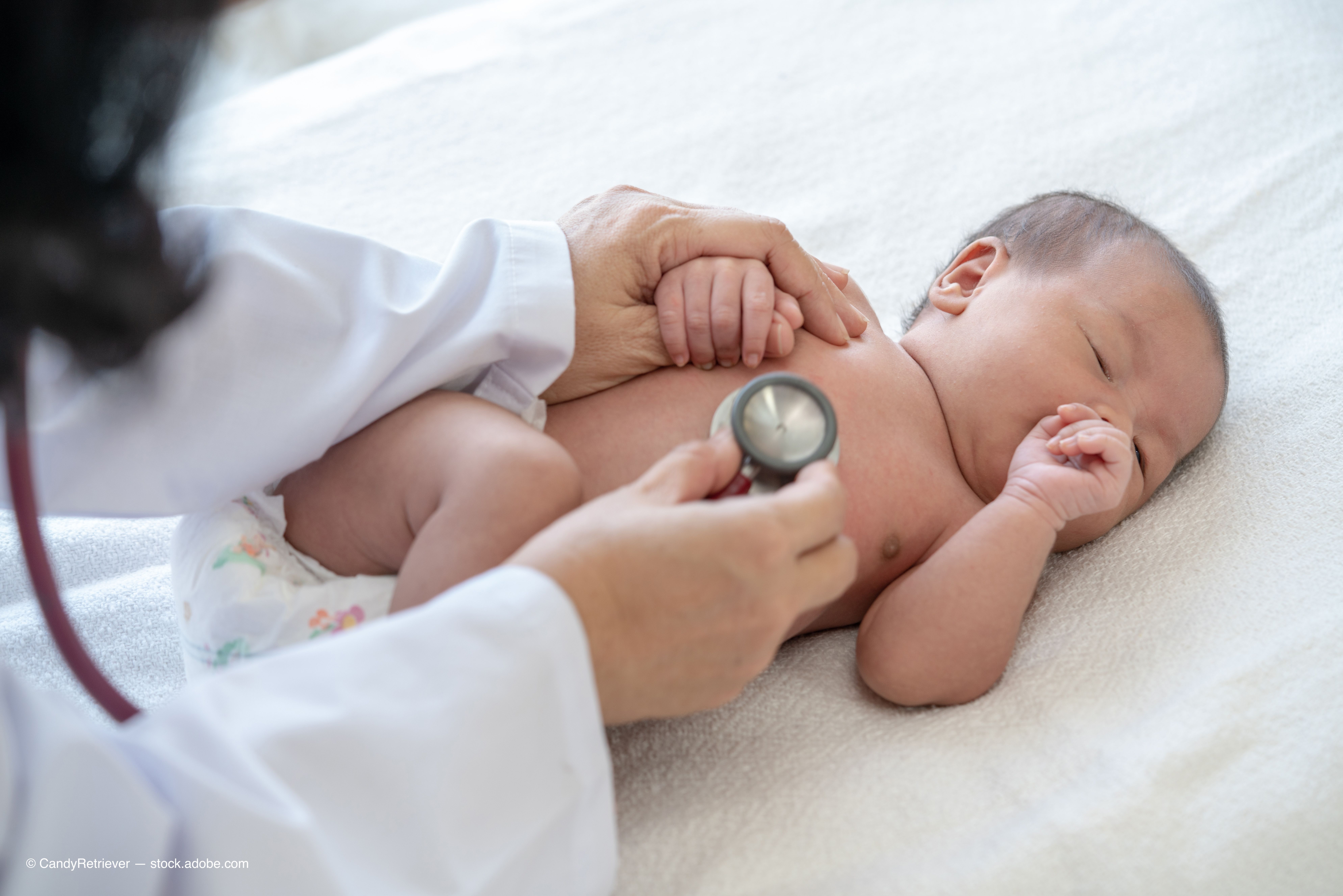 Study finds optic nerve pallor prevalent in ZIKA virus patients