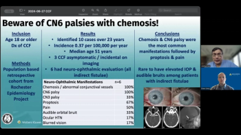 (Image credit: Ophthalmology Times) NeuroOp Guru: Cranial nerve six palsy with chemosis is a critical clue to cavernous carotid fistula
