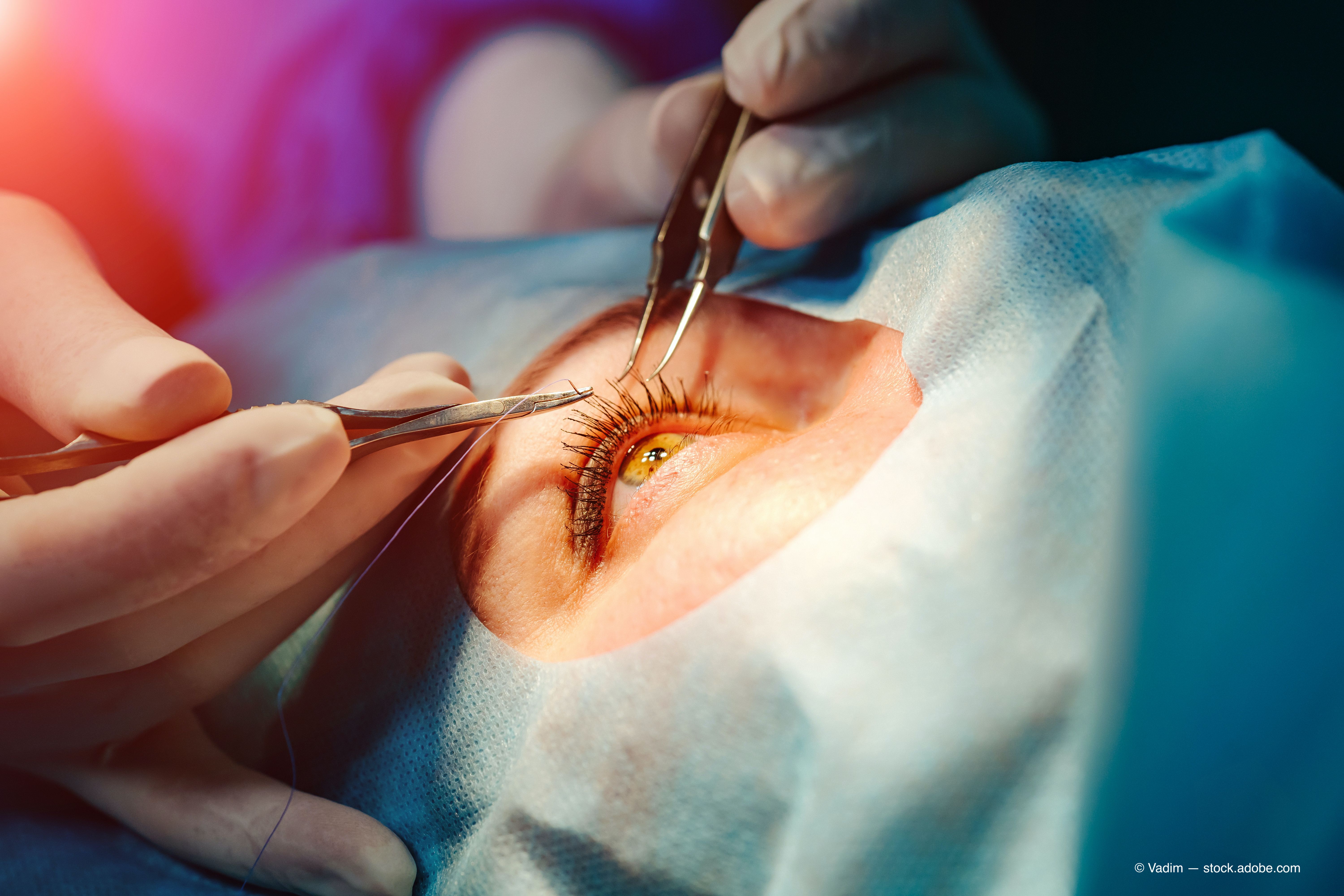 Celebrating a pivotal moment in laser-vision correction history 