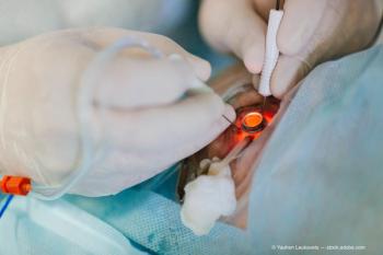 IOL implantation 